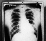 Image for Tuberculosis and the Māori People of the Wairoa District