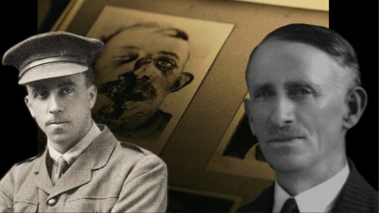 Hero image for Great War Stories 1 - Harold Gillies and Henry Pickerill