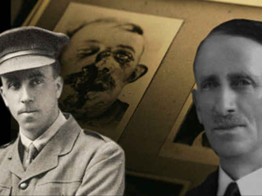Thumbnail image for Great War Stories 1 - Harold Gillies and Henry Pickerill