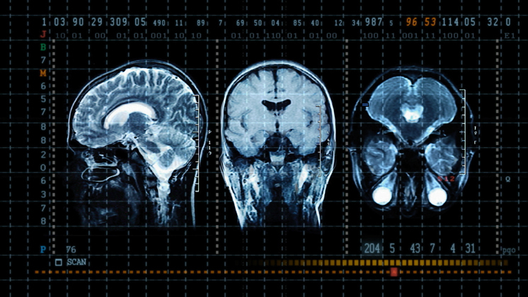 Hero image for Why Am I?  The Science of Us 2 - When Teens Run off the Rails (Episode Two)